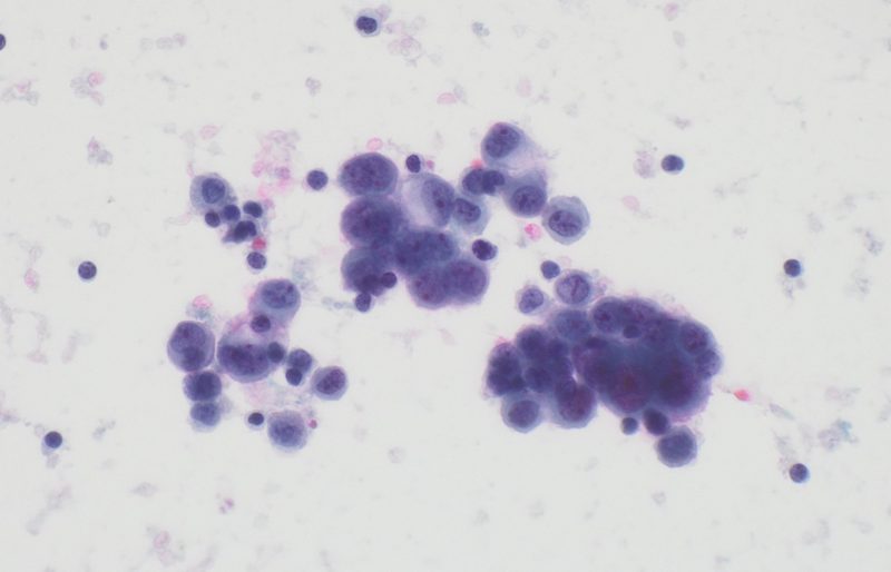Microscopy image representing cytopathology