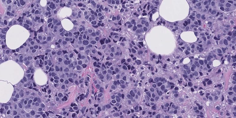 Microscopy image representing general surgical pathology