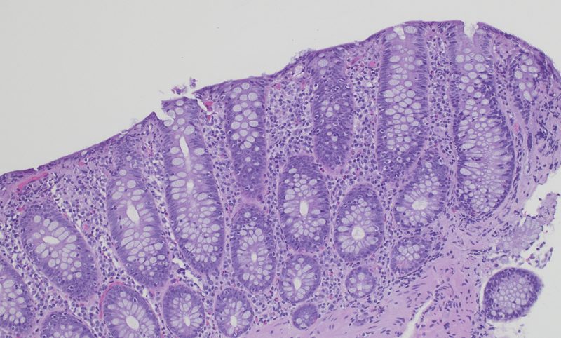 Microscopy image representing gastrointestinal and liver pathology