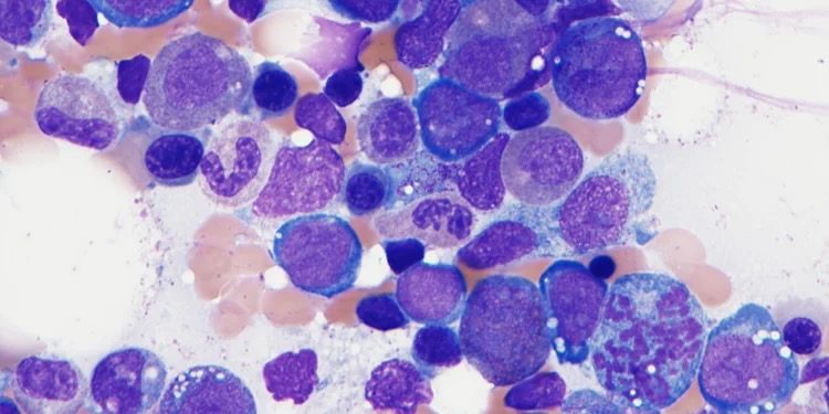 Microscopy image representing hematopathology